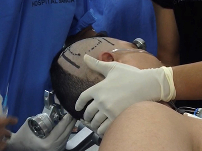 Neuroanaesthesia